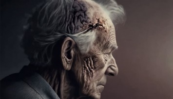 Alzheimer'a Çare Bulundu mu?