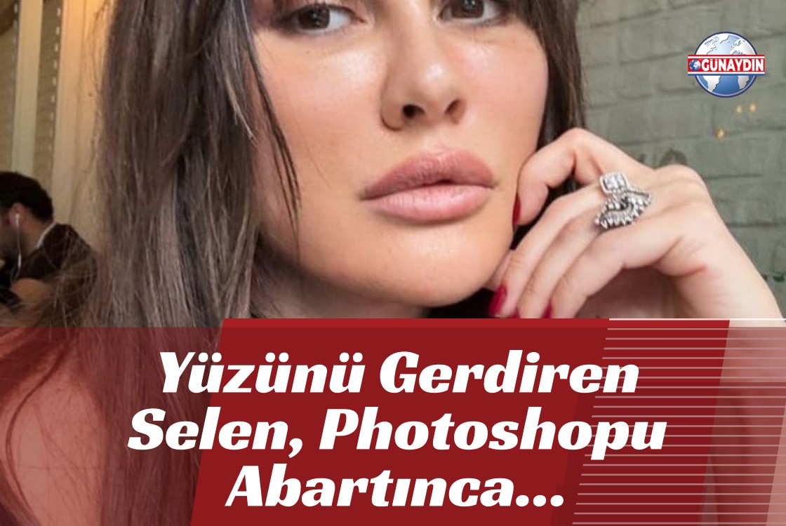 ÖZEL: Yüzünü Gerdiren Selen, Photoshopu Abartınca Tepki Çekti!