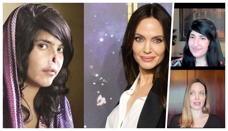 Angelina Jolie, Burnu Kesilen Aisha İle Röportaj Yaptı!