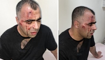 Gazeteci Sinan Aygül'e Saldırı!