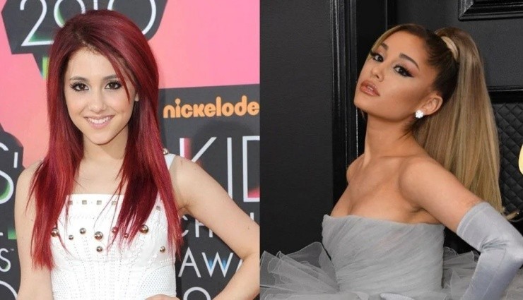 Ariana Grande: 'Birçok Kez Botoks Yaptırdım'