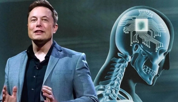 Elon Musk'ın Beyin Çipi Onay Aldı!