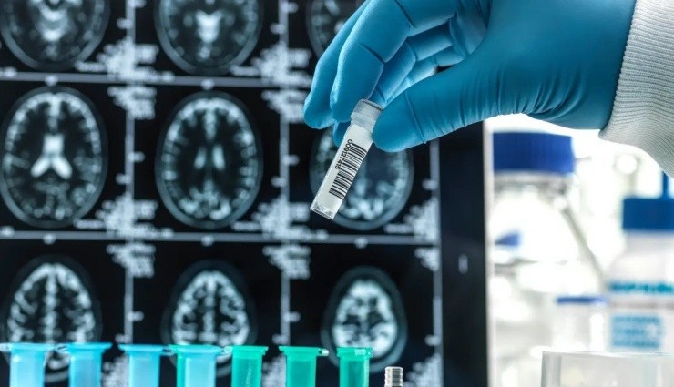 FDA'dan, Alzheimer İçin Yeni İlaca Onay!