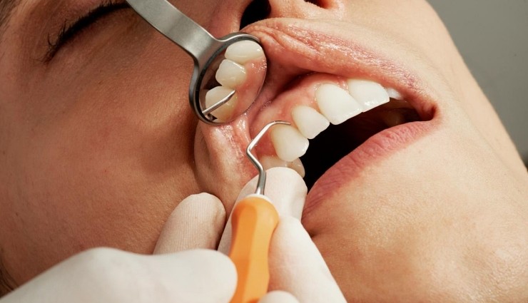 Diş Çıkarma İlacı Ne Zaman Piyasaya Sunulacak?