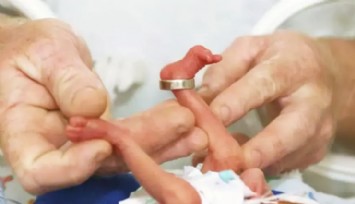 Yapay Plasenta: Prematüre Bebekler İçin Kurtarıcı mı?